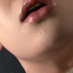 暗澹に挫き滅脈の静脈の音