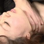 縊り首筋に索溝と崩落の痕跡