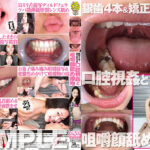 銀歯4本＆矯正具付き口腔視姦と咀嚼顔舐め接吻