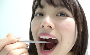 宮沢ちはるチャンの歯観察＆唾垂らし→乳首オナニー