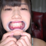 須崎美羽チャンの激レア歯口内観察＆涎垂らし電マ当て！